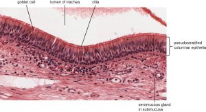 23.1 Anatomy and Normal Microbiota of the Respiratory Tract ...