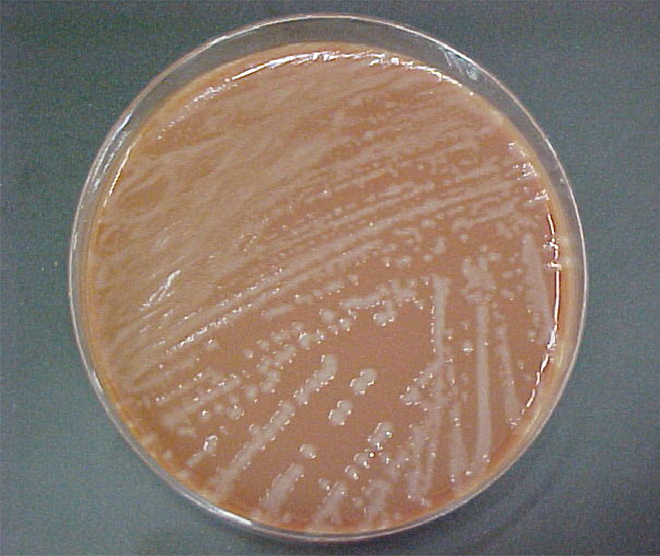 Photograph of white Haemophilus influenzae colonies on chocolate agar