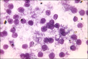 23.4 Respiratory Mycoses – Microbiology: Canadian Edition