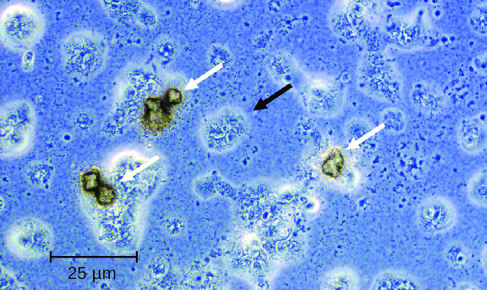 Micrograph showing oddly (roughly round) shaped structures.