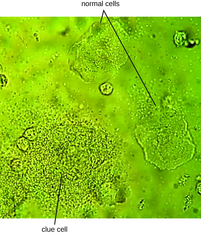Micrograph of larger human cells and smaller bacterial cells.