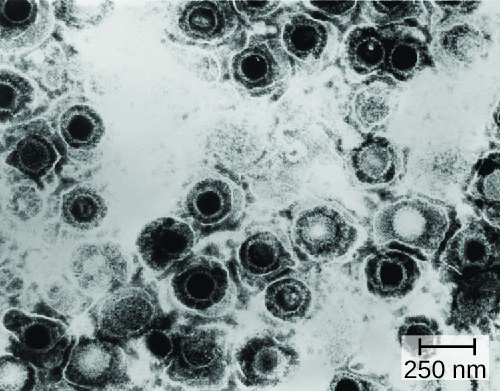 Micrograph of round structures.