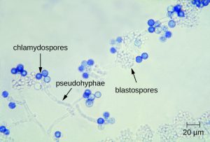 24.5 Fungal Infections of the Reproductive System – Microbiology ...