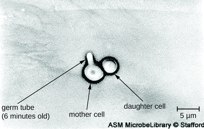 Micrograph of two circular cells attached to each other; one is labeled daughter cell and the other is labeled mother cell. The mother cell has a small protrusion labeled germ tube (6 minutes old).