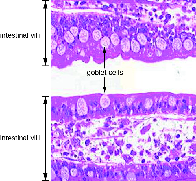 Micrograph of intestinal villi which are 2 pink regions separated by a clear space. The surface of each pink band is darker pink than the centre and the surface contains lighter pink oval cells labelled goblet cells.