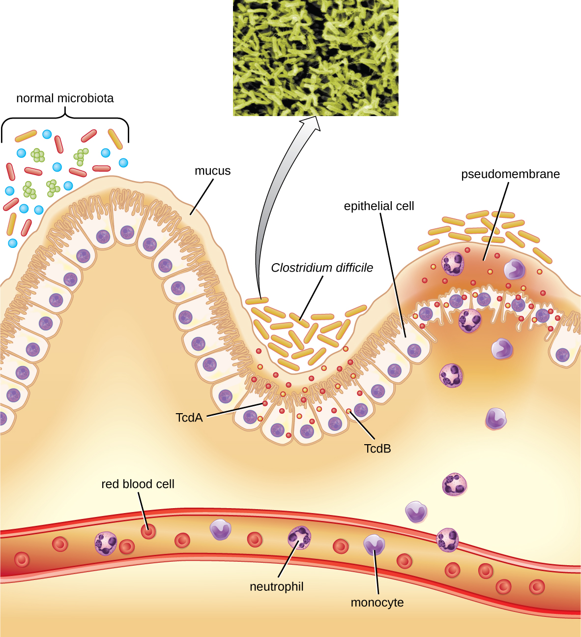 25.3 Bacterial Infections Of The Gastrointestinal Tract – Microbiology ...