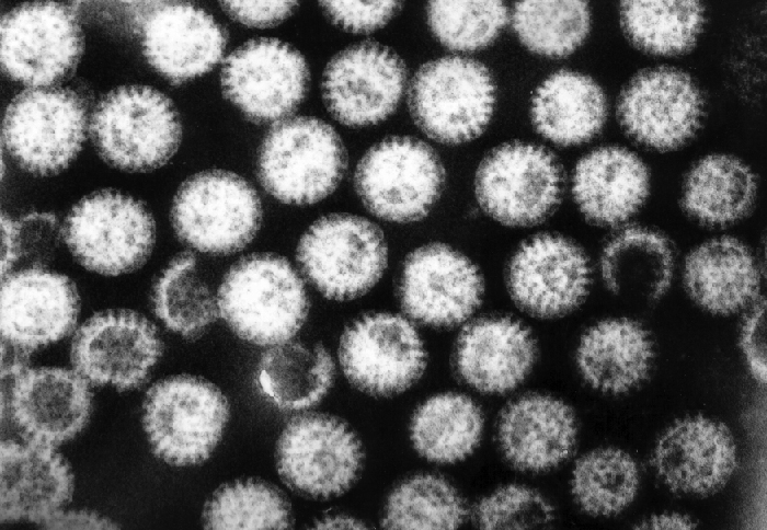 A micrograph of spherical viral particles with projections all over them.