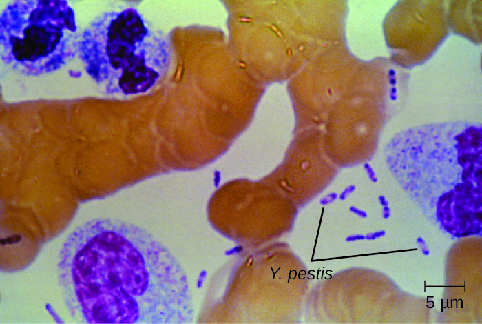 A micrograph showing small rod shaped purple cells in between larger human cells. The purple bacterial cells have a small clear circle in the centre.