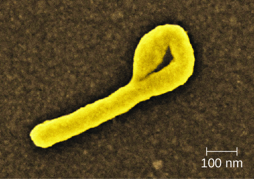 Micrograph of a straight cell with a straight cell that forms a loop on one end.