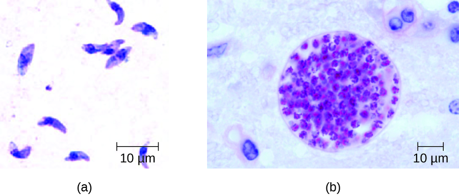 A) A micrograph of curved cells with a nucleus. B) micrograph of a sphere with many smaller spheres inside.