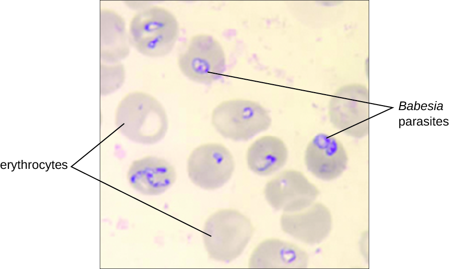 Micrograph of red blood cells with dark circles inside.