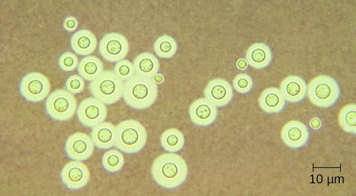 Micrograph of round cells with bright rings around them.