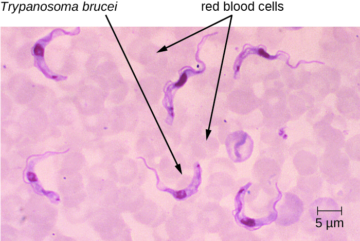 Micrograph of red circles labeled red blood cells and worm-shaped cells labeled Trypanosoma brucei.