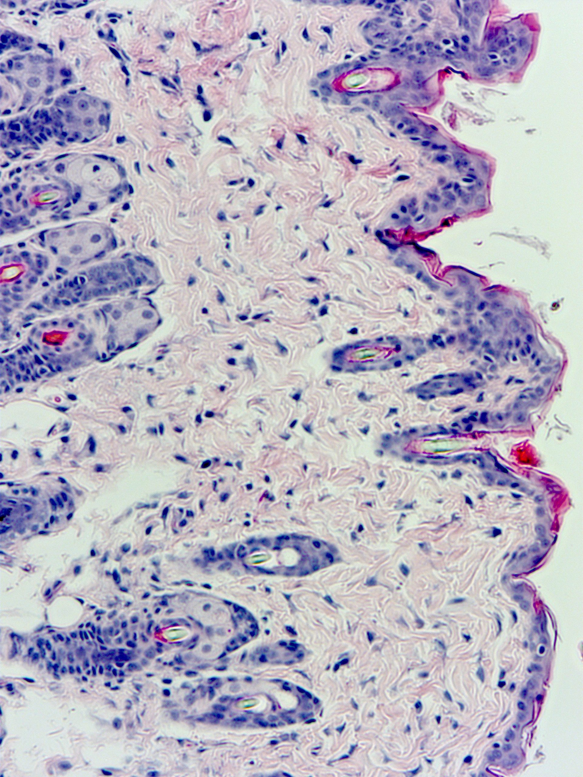 The different tissue layers of the skin cross section in the image are stained different colours. The epidermis is dark purple, while the layer immediately beneath it (the dermis) is light pink.