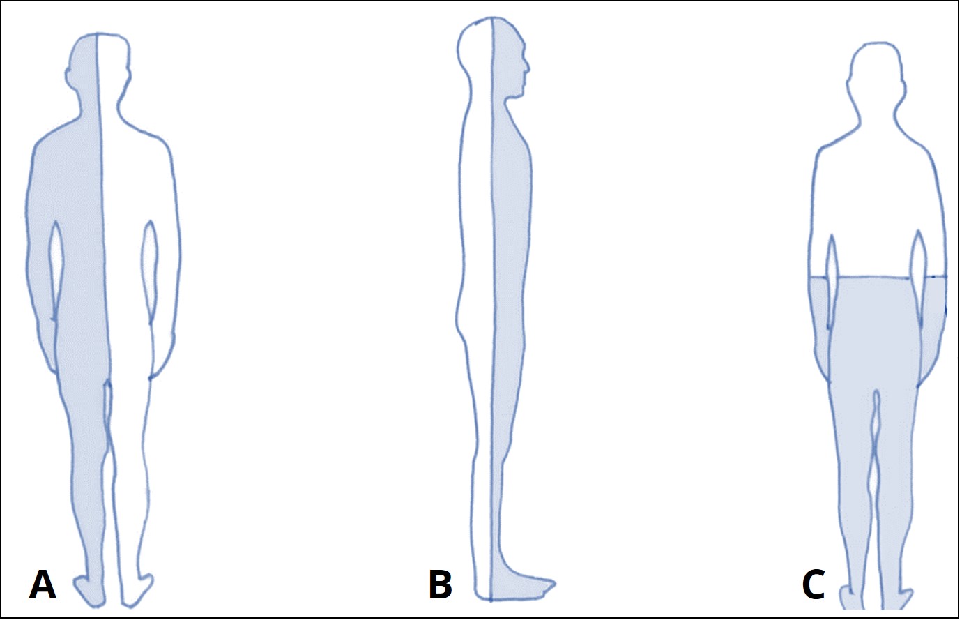 Graphic image describing longitudinal, frontal/coronal, transverse/horizontal sections of the human body.