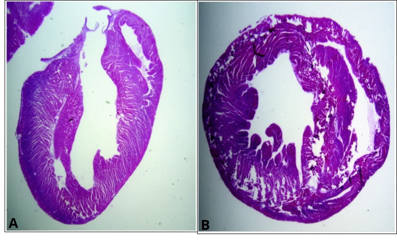 Microscope image of a stained whole animal heart and atrial tissue obtained from a euthanized mouse.