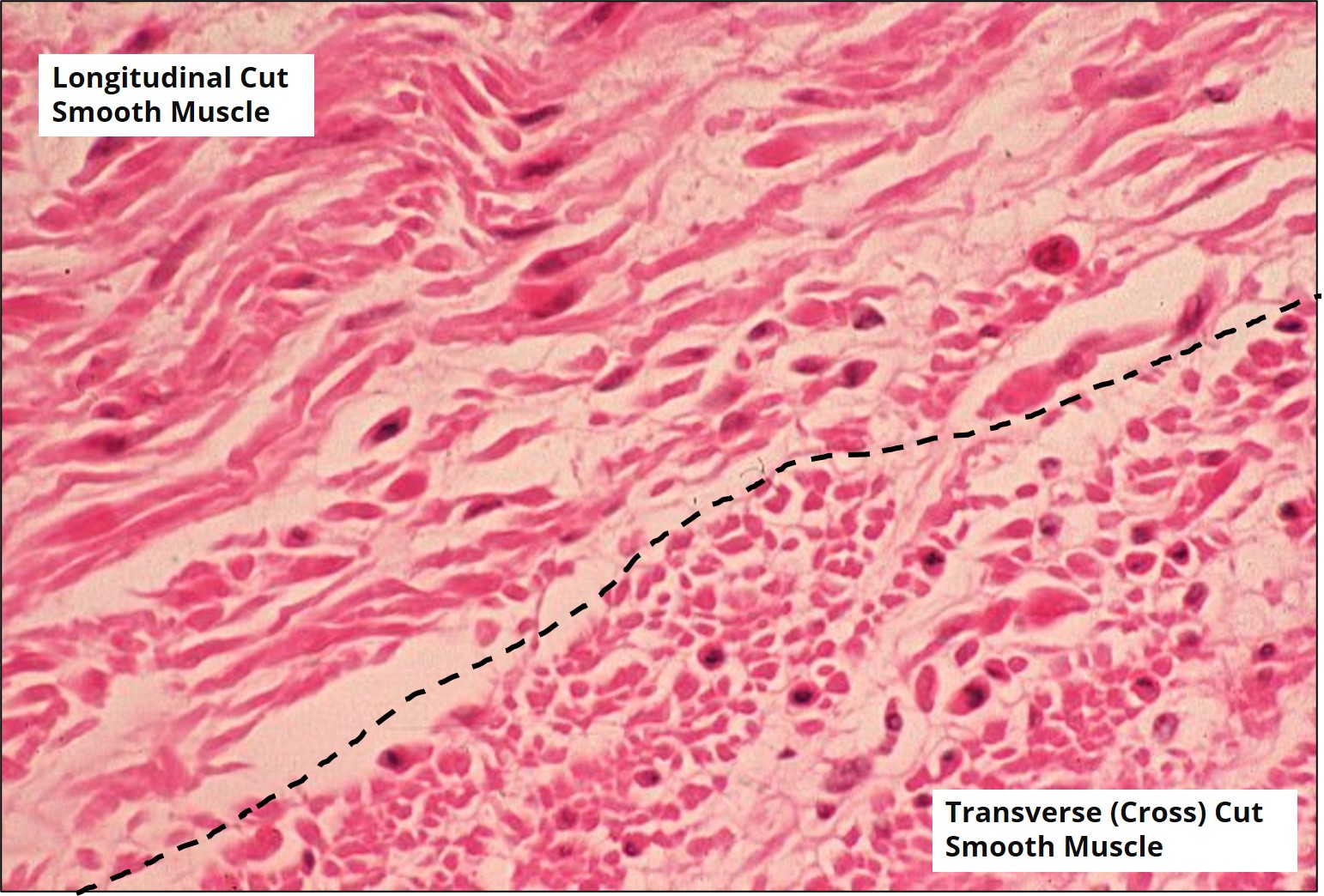 Microscope image of longitudinal cuts and transvere cuts of human smooth muscle.