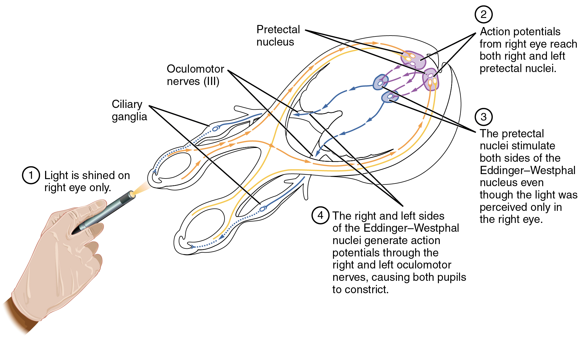 This diagram shows the connections between the different nerves and pathways in the eyes. A hand is shown shining a light on the right eye, and arrows and text callouts indicate the different pathways that are activated.