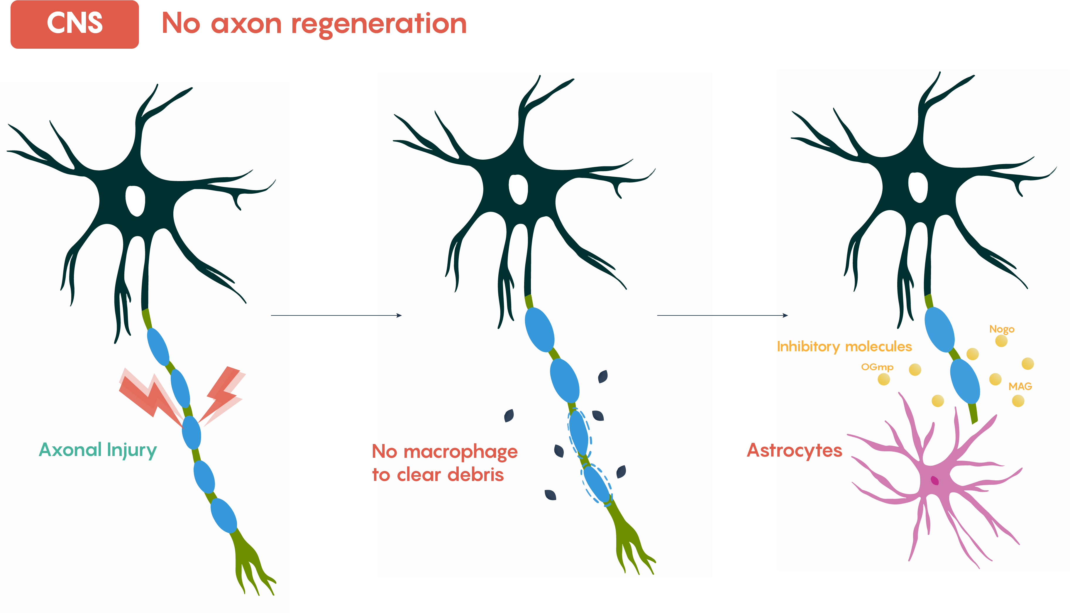 La imagen muestra la falta de regeneración axonal en el SNC.