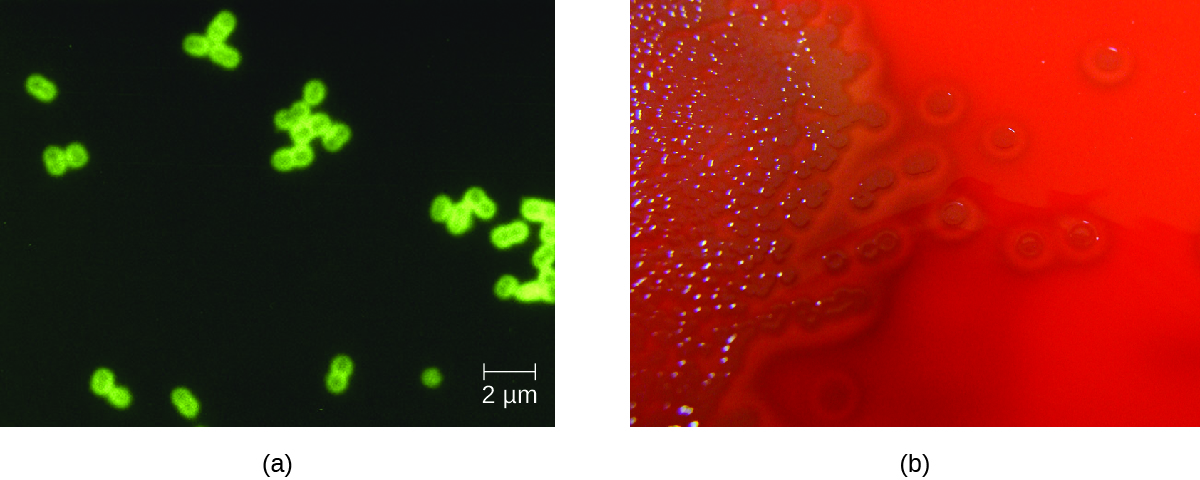 a)Micrograph of green closing circles in pairs on a dark background. Photograph of a red plate with brown colonies. Clearing is seen around the colonies.