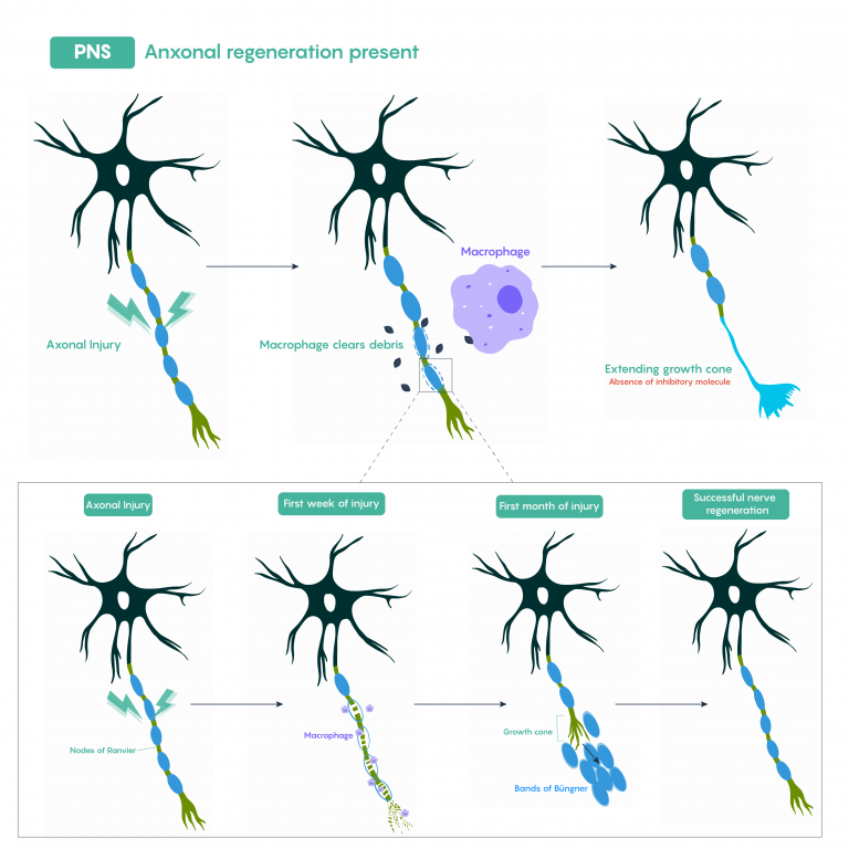 Acute Physical Damage To The Nervous System Medicine LibreTexts