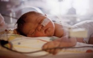 A photograph of a newborn receiving treatment in a hospital.
