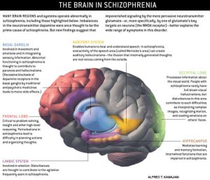 Many brain regions and systems operate abnormally in schizophrenia, including the basal ganglia, frontal lobe, limbic system, auditory system, occipital lobe, and hippocampus.