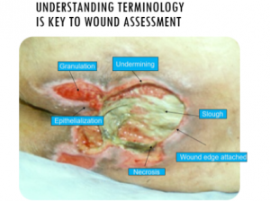 Wound Bed Appearance