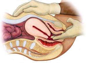 Cutaway diagram of bimanual pelvic exam. Medium skin tone.