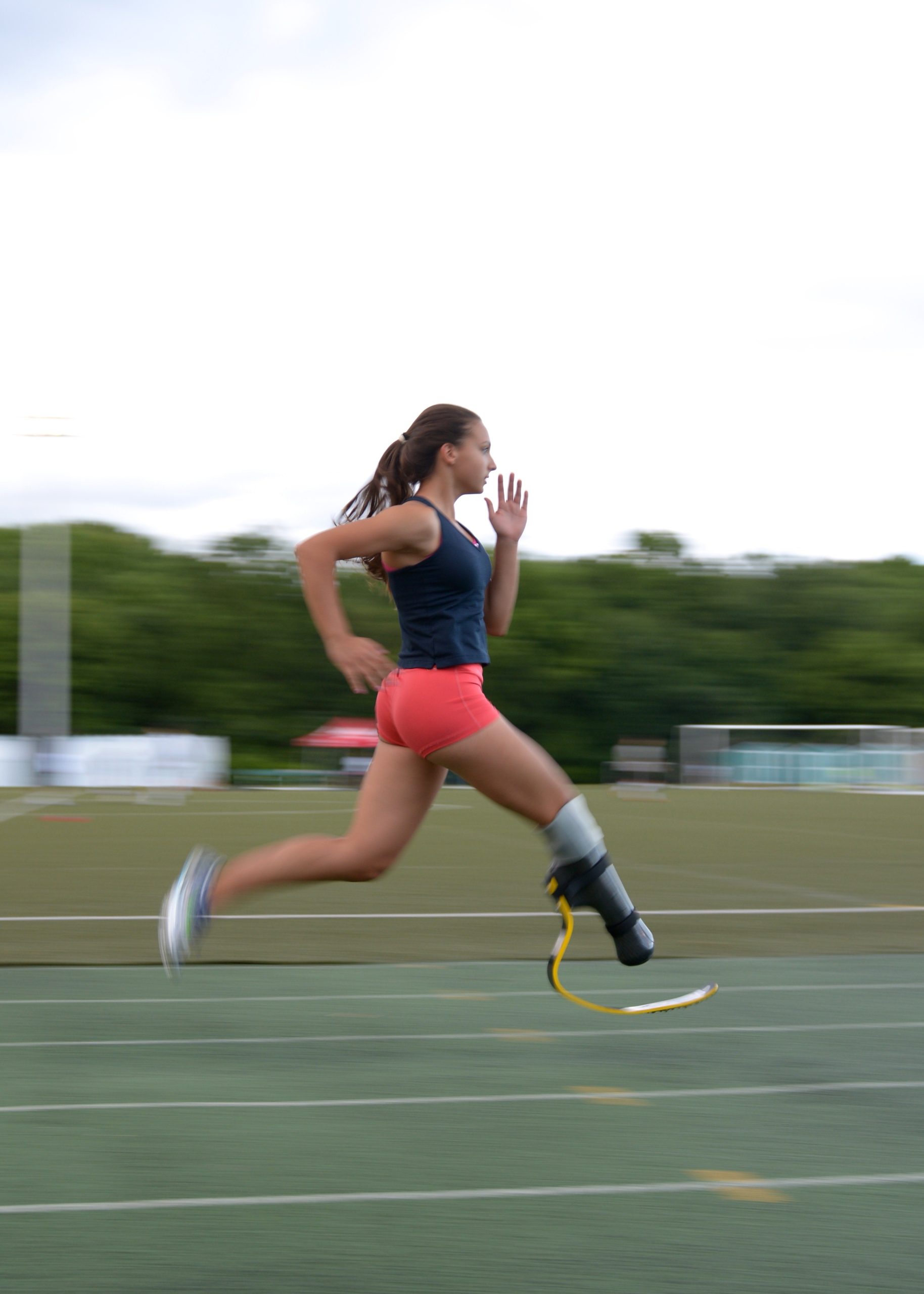This image is of a young female single leg amputee para-athlete using a single spring prosthetic runs on a track; she has a long ponytail that flows behind her head and wears pink shorts and a blue tank top; blurry outdoors with trees in the background.