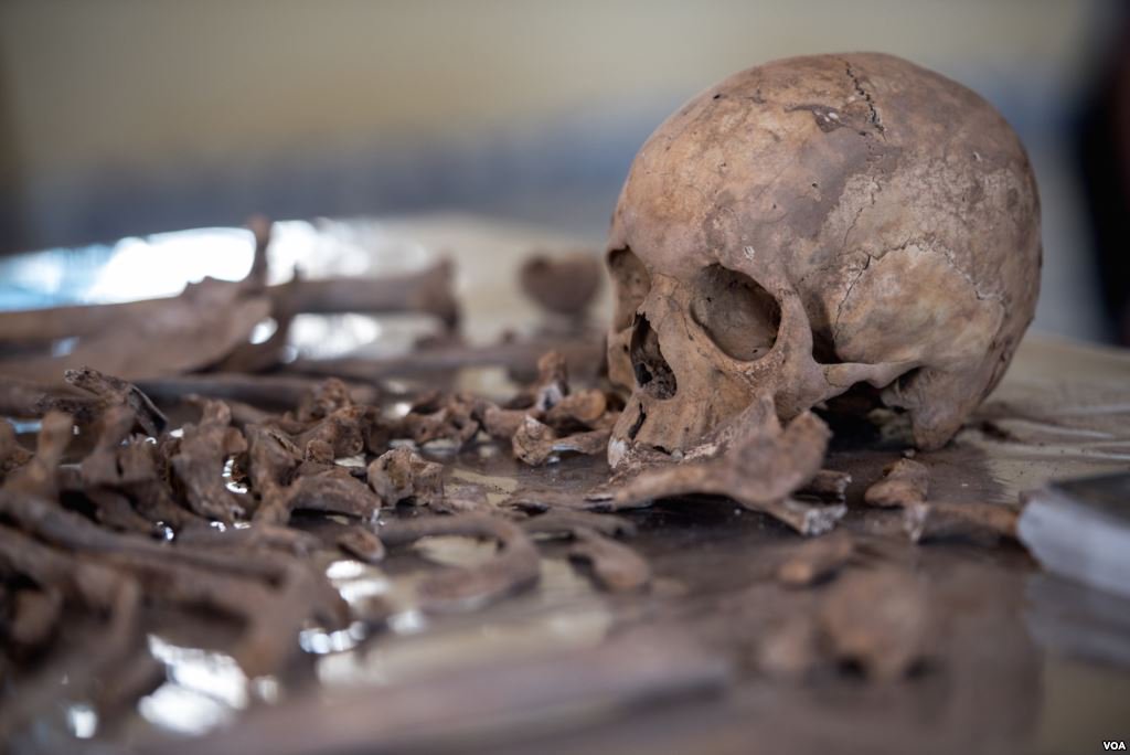 Exhumed skeletal remains of victims of the Isaaq genocide found from a mass grave site located in Berbera, Somaliland.