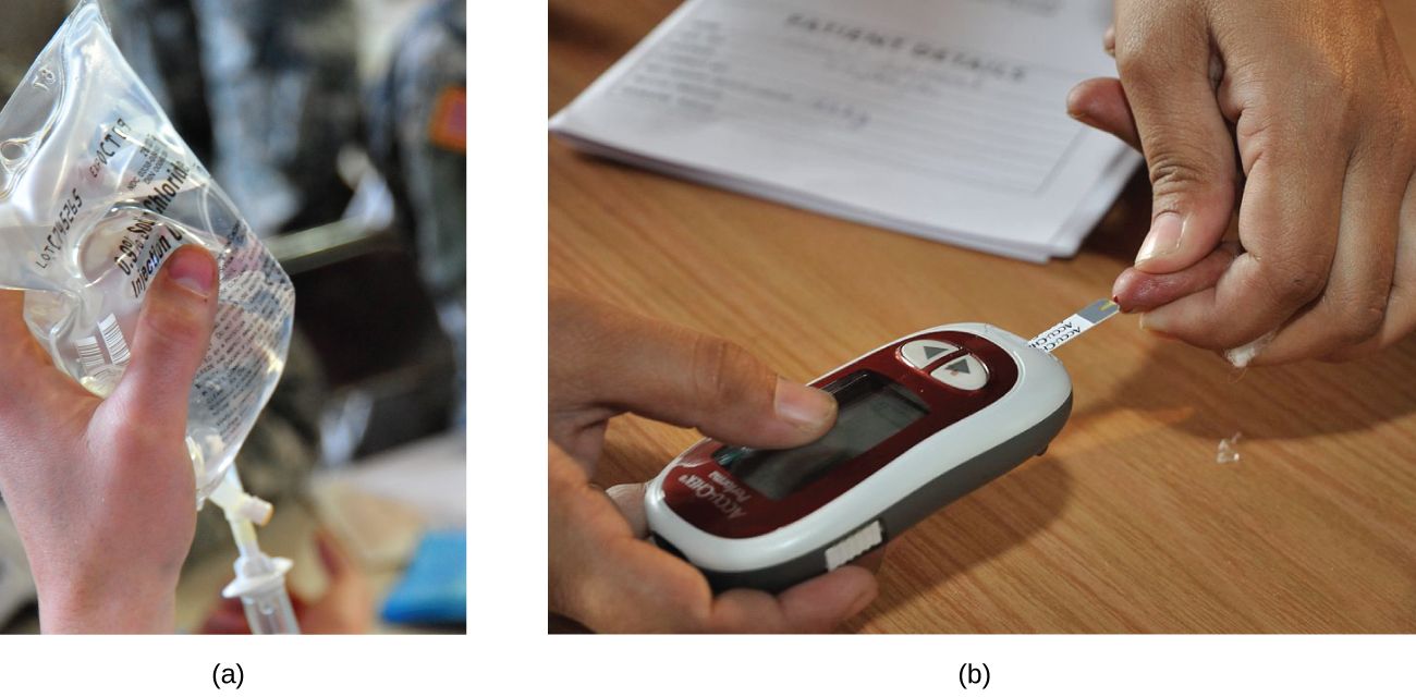 Two pictures are shown labeled a and b. Picture a depicts a clear, colorless solution in a plastic bag being held in a person’s hand. Picture b shows a person’s hand holding a detection meter with a digital readout screen while another hand holds someone’s finger up to the end of the meter. The meter is pressed to the drop of blood that is at the end of the person’s finger.