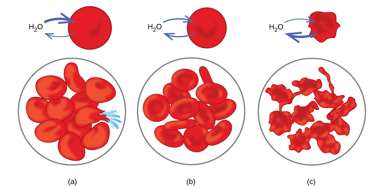 This figure shows three scenarios relating to red blood cell membranes. In a, H subscript 2 O has two arrows drawn from it, with a thicker arrow pointing into a red disk. Beneath it in a circle are eleven similar disks with a bulging appearance, one of which appears to have burst with blue liquid erupting from it. In b, the image is similar except that rather than having arrows pointing into and out of the red disk, one points in and a second points out toward the H subscript 2 O. In the circle beneath, twelve of the red disks are present. In c, two arrows are drawn, a thicker arrow from the red shriveled disk toward the H subscript 2 O. In the circle below, twelve shriveled disks are shown