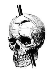 A skull with a bar piercing down through the top of the head and through the jaw.