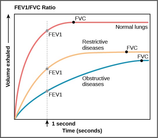 Figure 20.18.  The ratio of FEV1 (the amount of air that can be forcibly exhaled in one second after taking a deep breath) to FVC (the total amount of air that can be forcibly exhaled) can be used to diagnose whether a person has restrictive or obstructive lung disease. In restrictive lung disease, FVC is reduced but airways are not obstructed, so the person is able to expel air reasonably fast. In obstructive lung disease, airway obstruction results in slow exhalation as well as reduced FVC. Thus, the FEV1/FVC ratio is lower in persons with obstructive lung disease (less than 69 percent) than in persons with restrictive disease (88 to 90 percent).