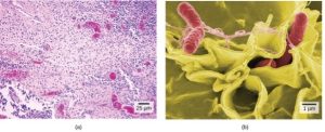 Figure 4.3 (a) Ces bactéries de salmonelles apparaissent comme de minuscules points violets lorsqu'on les observe au microscope optique. (b) Cette micrographie au microscope électronique à balayage montre des bactéries salmonelles (en rouge) envahissant des cellules humaines (en jaune). Même si la figure (b) montre un spécimen de Salmonelle différent de la figure (a), vous pouvez observer l'augmentation comparative du grossissement et des détails. (crédit a : modification du travail par CDC/Armed Forces Institute of Pathology, Charles N. Farmer, Rocky Mountain Laboratories ; crédit b : modification du travail par NIAID, NIH ; données de la barre d'échelle de Matt Russell)