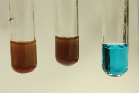 The results of the Benedict’s Test shown in 3 test tubes. From left to right show two brown solutions and one blue solution.