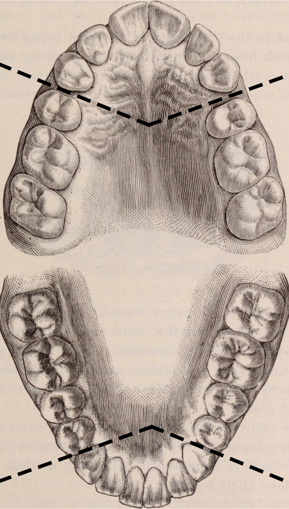 Top of image is line drawing of upper teeth and palate; bottom of image is line drawing of lower teeth and palate with dotted lines separating front teeth from molars; dotted lines separate the front teeth from molars, therefore delineating six sections total.