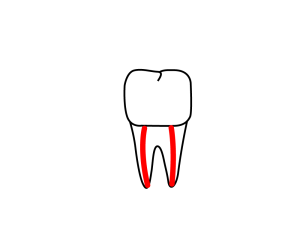 Line drawing of molar with red line from tip of root to crown on each root.