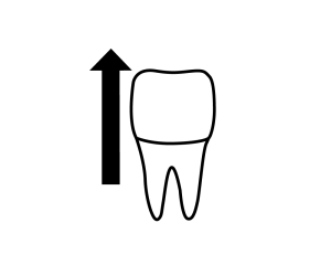 Line drawing of tooth on dental chart with an arrow on the left side, pointing up from the middle of the root to above the crown.