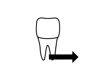 Line drawing of tooth on a dental chart with an arrow pointing from the right root tip to the right.