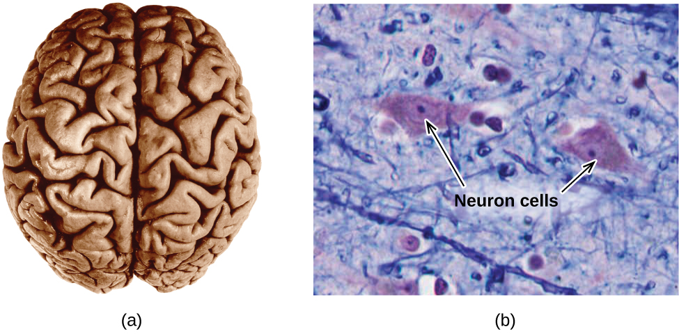 A macroscopic top view of the human brain and a microscopic image of neural tissue are pictured. The neural tissue shows two large irregularly shaped masses, labelled “Neuron cells”, in a field of threadlike material interspersed with smaller, relatively round masses.