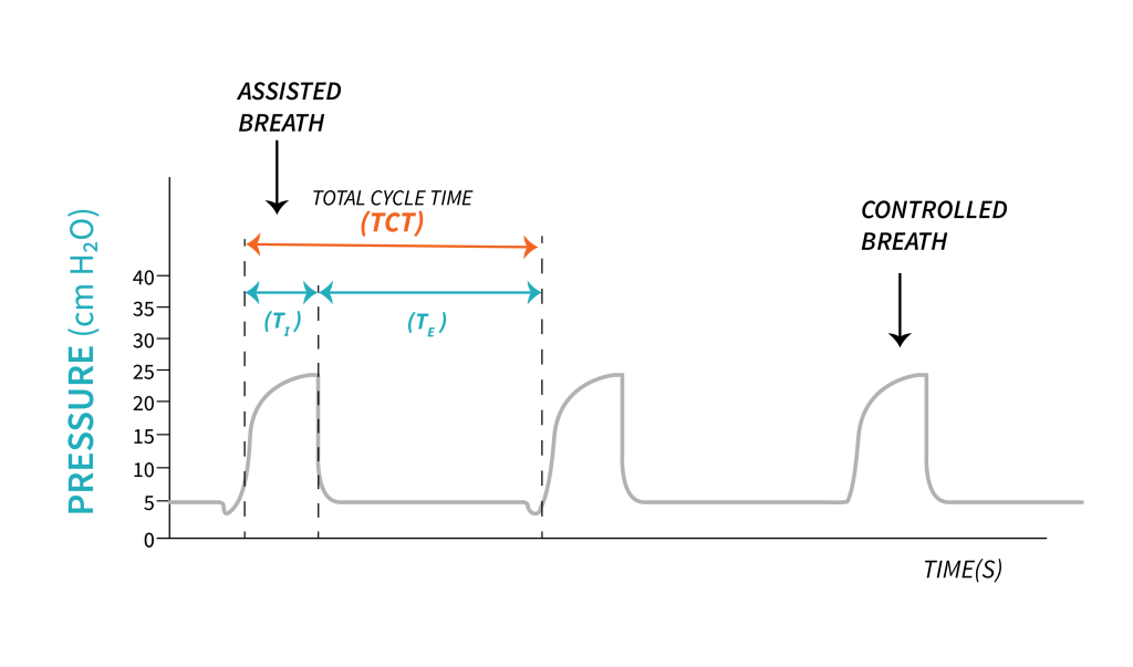 A trigger diagram is shown with time in seconds on the x-axis and pressure in centimetres H2O on the y-axis. Each rise in the graph represents a breath, with the first being the assisted breath with a small dip at the beginning and the third being the controlled breath.