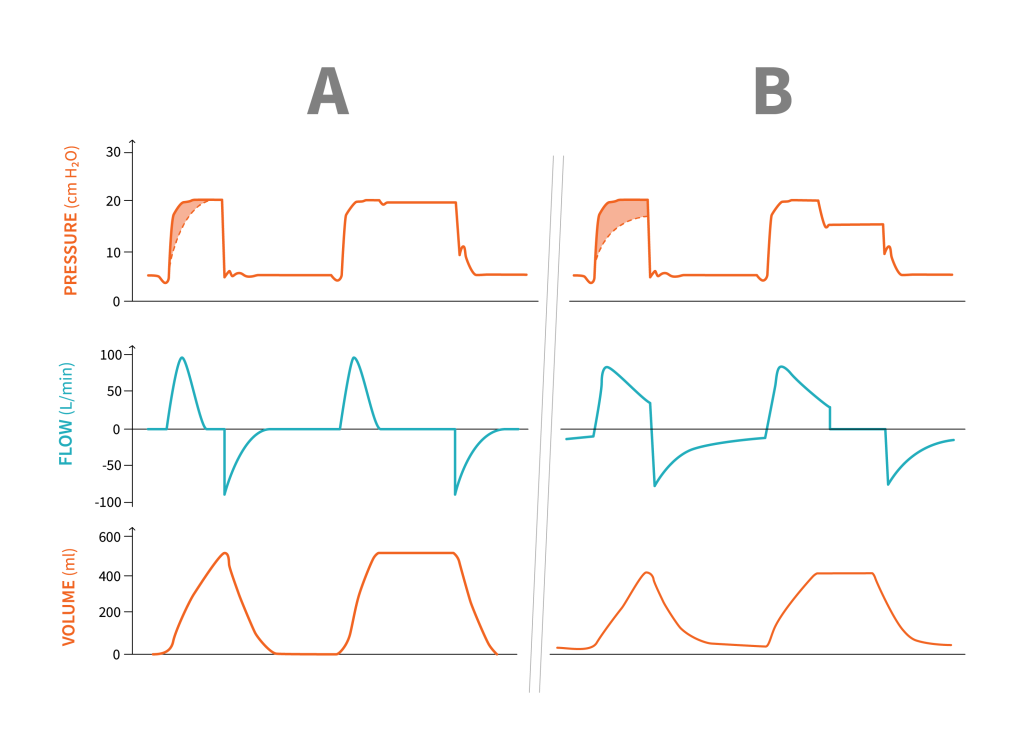 Two diagrams, A and B are shown with pressure, flow and Volume. In the pressure diagram, the pressure inflating the alveoli is that which reaches the dotted line and the pressure spent to generate the flow is that shaded in orange above the dotted line.