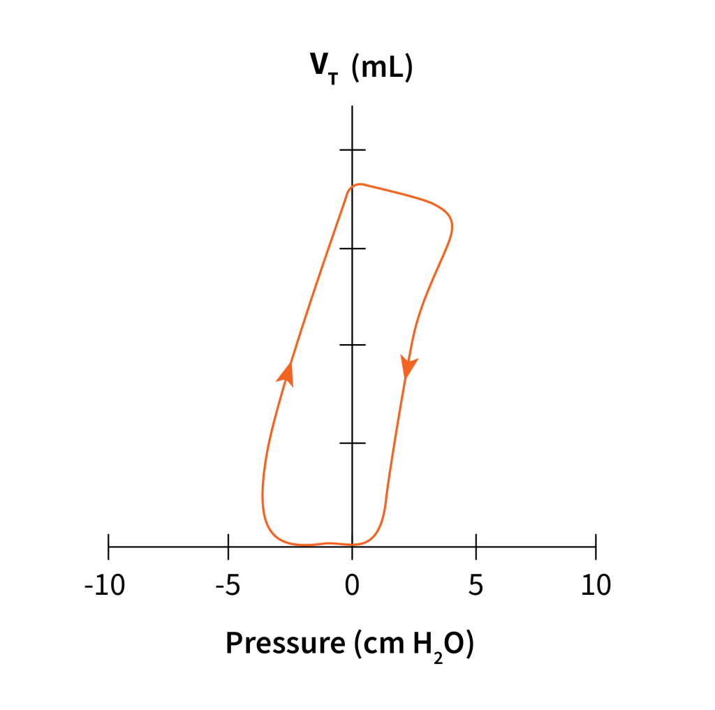 8.6 Patient-Ventilator Interaction & Graphic Representation of ...