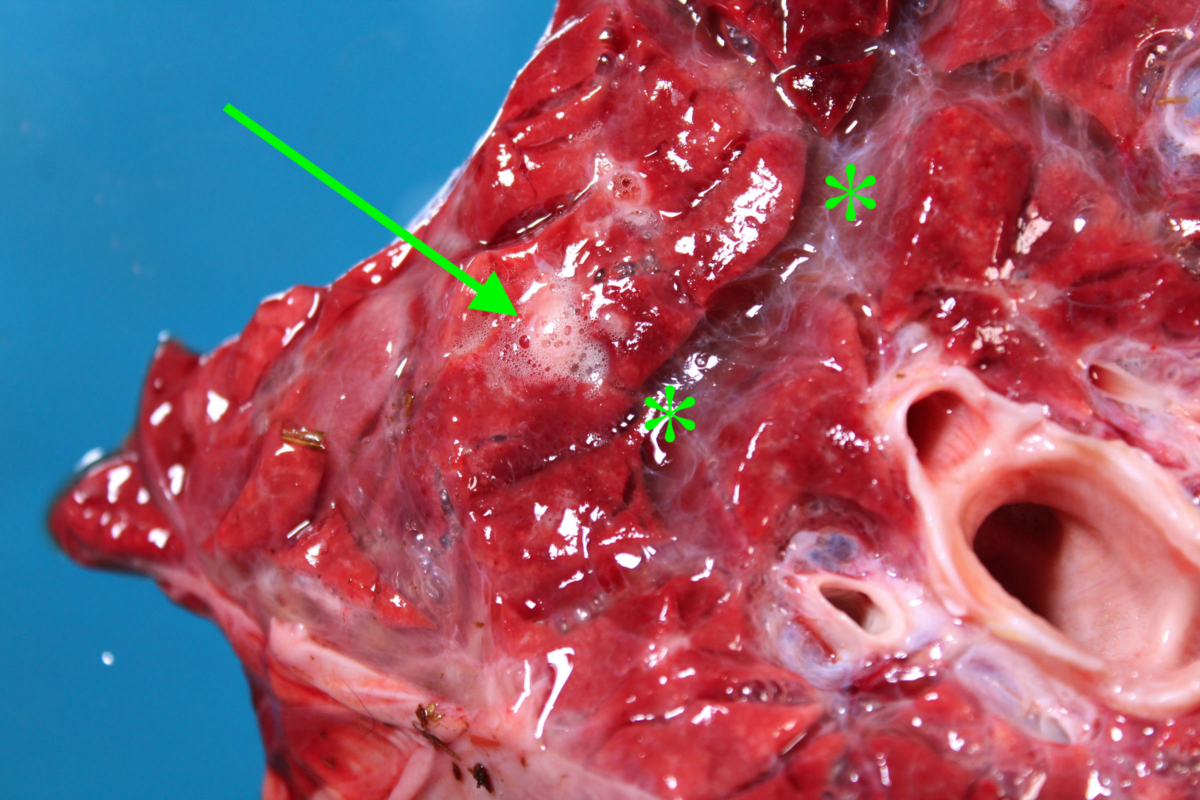 Gross image of pulmonary edema.