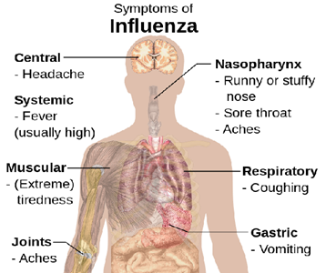 Symptoms if influenza shown on a diagram of a body based on where they present.