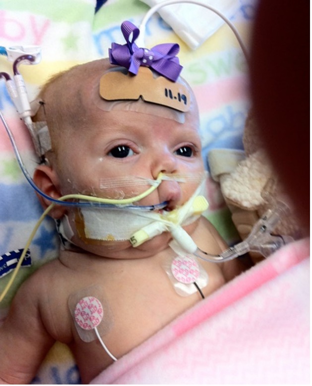 A small baby is in a hospital bed and has tubes attached to their mouth and in their nose.