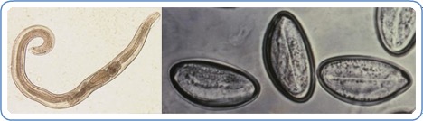 A microscope image of a pinworm and pinworm eggs.