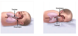 Two images show a baby sleeping on their back with a clear airway, and a baby sleeping on their stomach with the sheet covering part of their mouth.